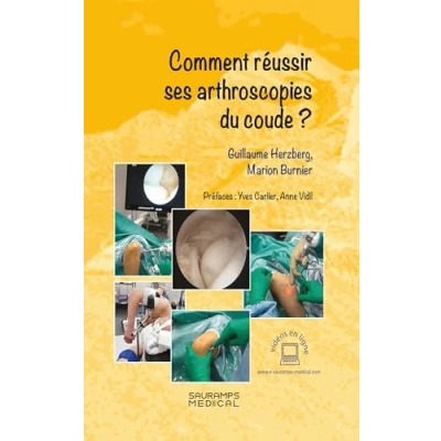 Afbeelding van COMMENT REUSSIR SES ARTHROSCOPIES DU COUDE