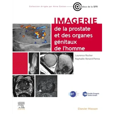 Afbeelding van IMAGERIE DE LA PROSTATE ET DES ORGANES GENITAUX L&#039;HOMME