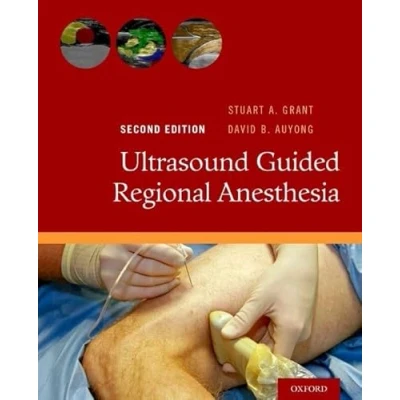 Afbeelding van Ultrasound Guided Regional Anesthesia